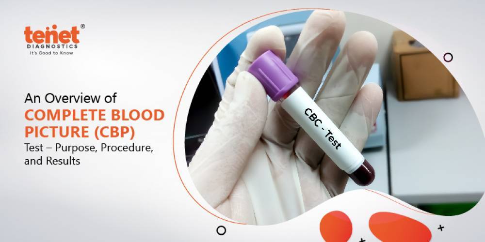 COMPLETE BLOOD COUNT