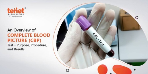 COMPLETE BLOOD COUNT